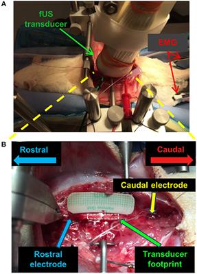 Functional Ultrasound Imaging of Spinal Cord Hemodynamic Responses to Epidural Electrical Stimulation: A Feasibility Study